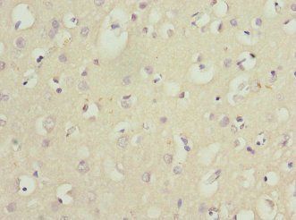 BEX3 Antibody