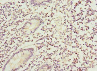 BFAR Antibody