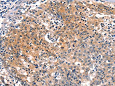 BFAR Antibody