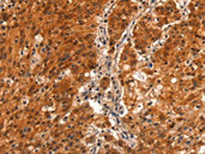 BFAR Antibody