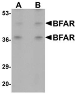 BFAR Antibody
