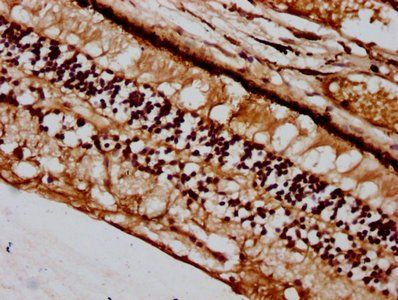 BFSP2 Antibody