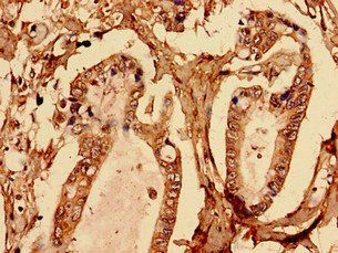 BGN antibody