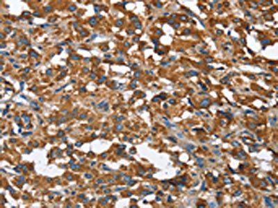 BGN Antibody