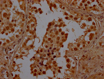 BHLHE23 Antibody