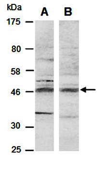BHLHE40 antibody pair