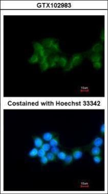 BHMT Rabbit Polyclonal Antibody
