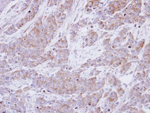 BHMT Rabbit Polyclonal Antibody