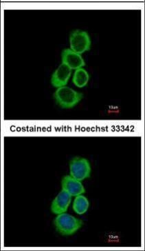 BHMT Rabbit Polyclonal Antibody