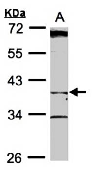 BHMT2 antibody