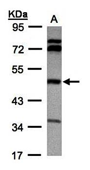 betaine-homocysteine methyltransferase antibody