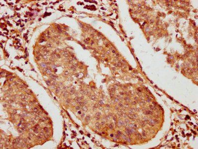 BICC1 Antibody