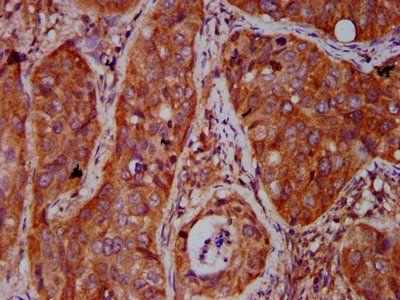 BICD2 Antibody
