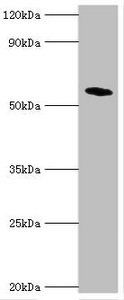 Bile acid R antibody