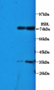 Bile salt-activated lipase antibody