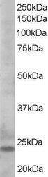 BCL2L11 antibody