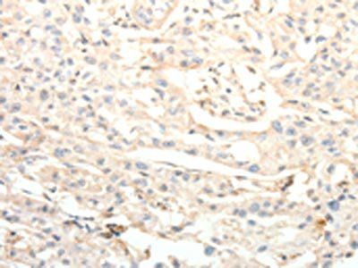 BIRC2 Antibody
