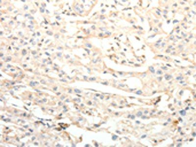 BIRC2 antibody