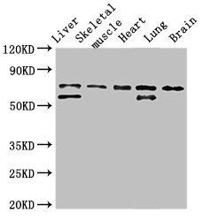 BIRC2 Antibody