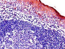 BIRC3 Antibody