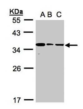 bisphosphoglycerate mutase antibody