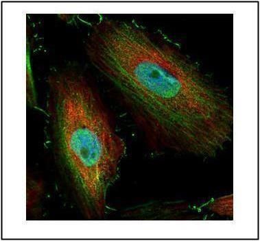 BIVM Rabbit Polyclonal Antibody