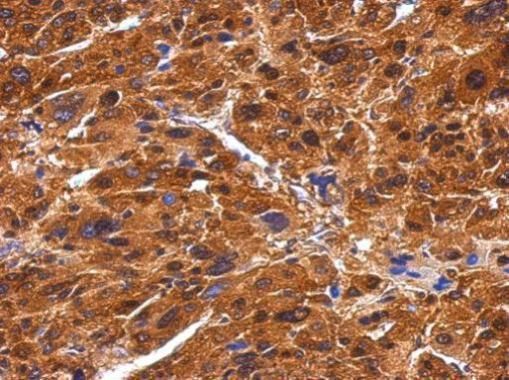 BIVM Rabbit Polyclonal Antibody