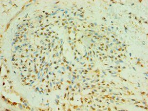 BLK Antibody