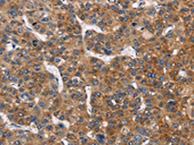 BLK Antibody