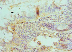 BLMH Antibody