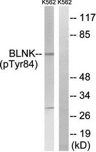 BLNK (phospho-Tyr84) antibody