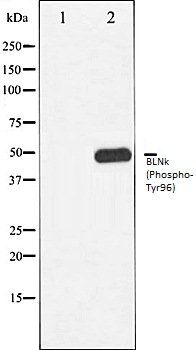 BLNk (Phospho-Tyr96) antibody