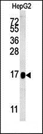 BLOC1S2 antibody