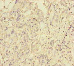 BLOC1S6 Antibody