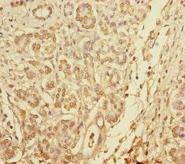 BLOC1S6 Antibody