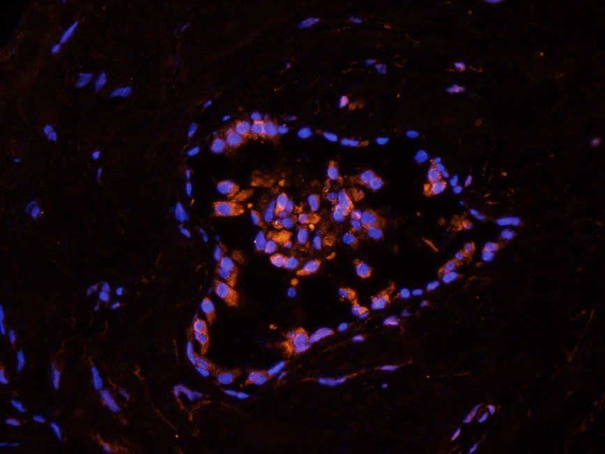 BMI1 antibody