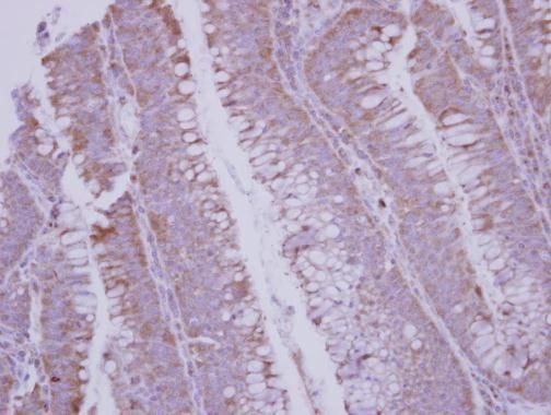 BMP10 antibody [C3], C-term