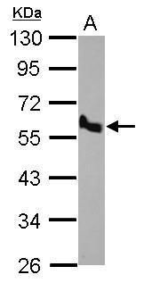 BMP10 Rabbit Polyclonal Antibody