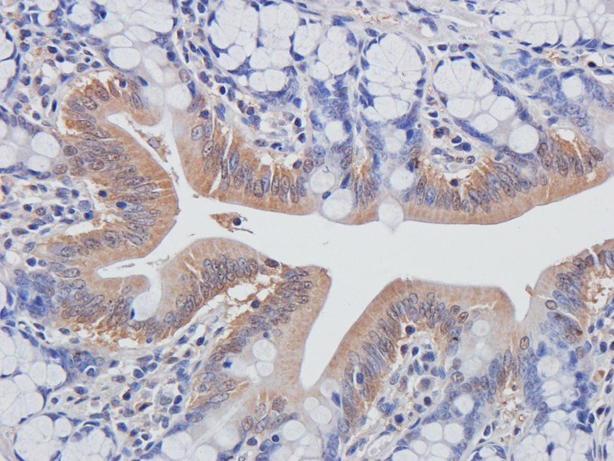 BMP11 antibody