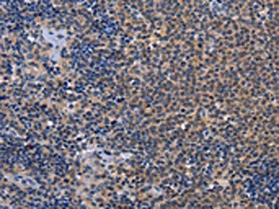 GDF11 Antibody