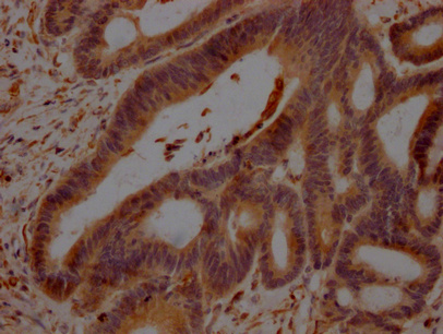 GDF11 Antibody