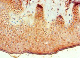 BMP15 Antibody