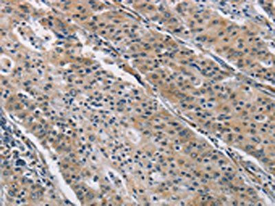 BMP15 Antibody
