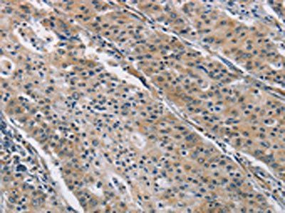 BMP15 antibody