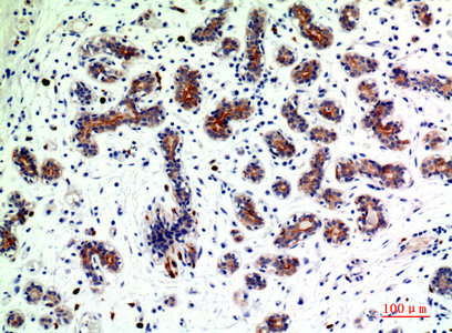 BMP2 antibody