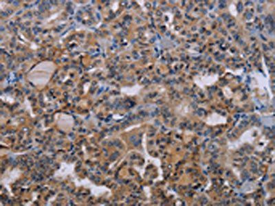 BMP3 Antibody