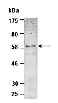 BMP3 antibody