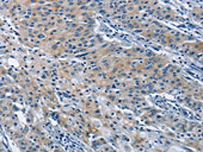 BMPR1B Antibody