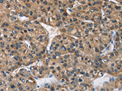 BMPR1B Antibody