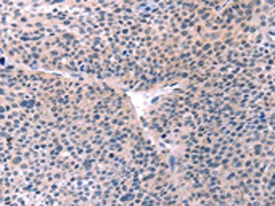 BMPR2 antibody